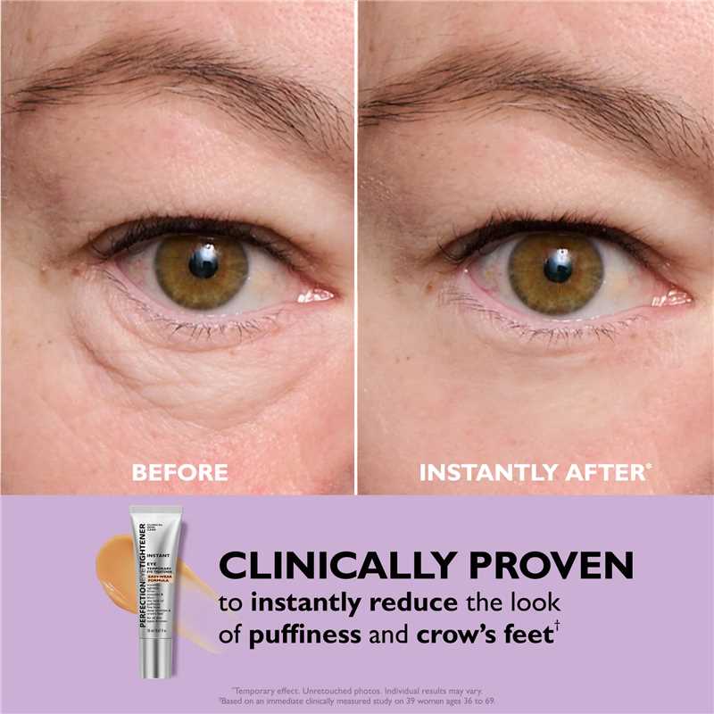 Last Chance! 70% OFF 🔥 Instant Eye Tightener – Smooth Formula + Free Brush Included!